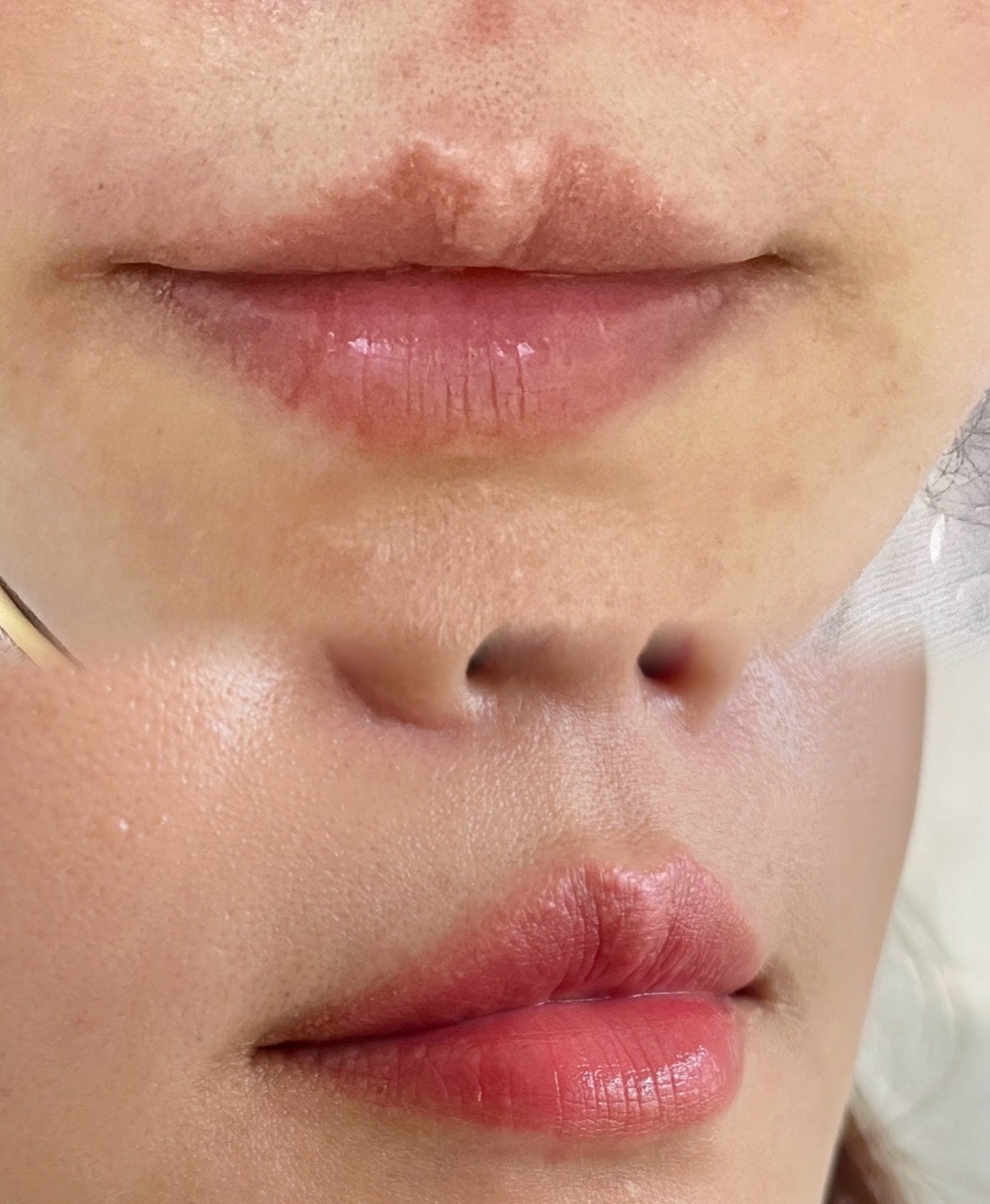 Lip Blush case 02: two close-up views of the same lips