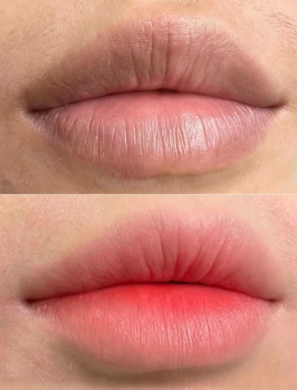 Lip Blush case 03: two close-up views of the same lips
