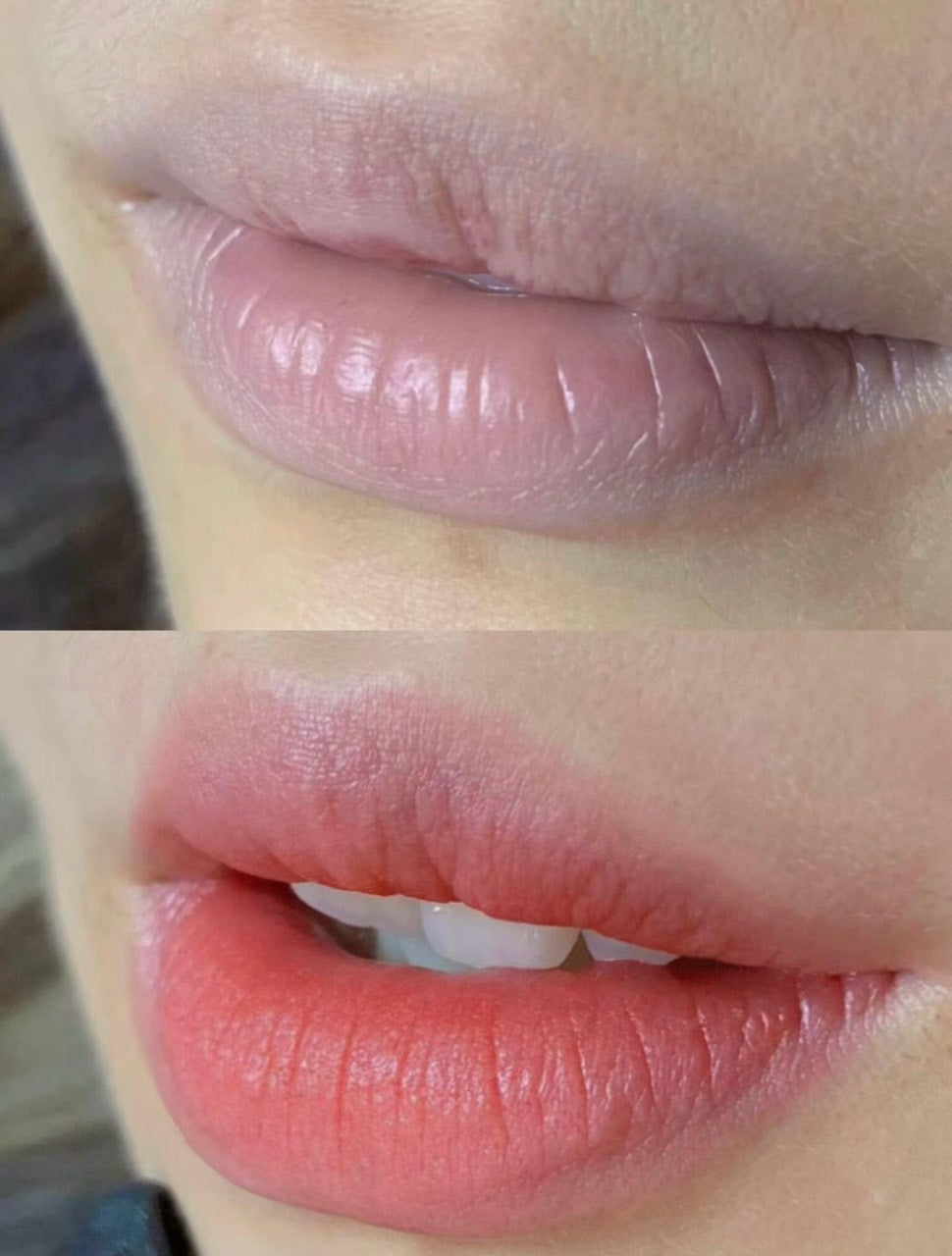 Lip Blush case 04: two close-up views of the same lips